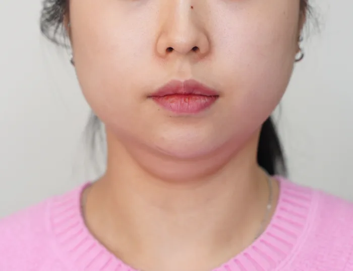 Before: HaruFit™ Light