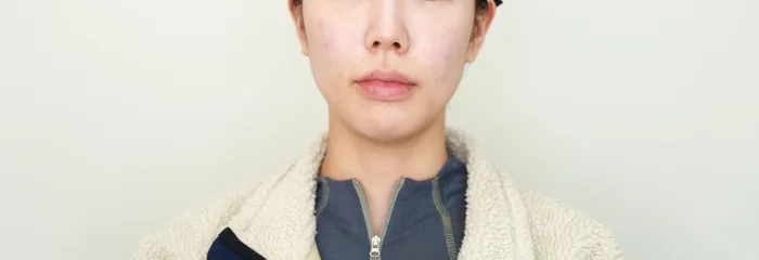 After: 乔雅露 Volume