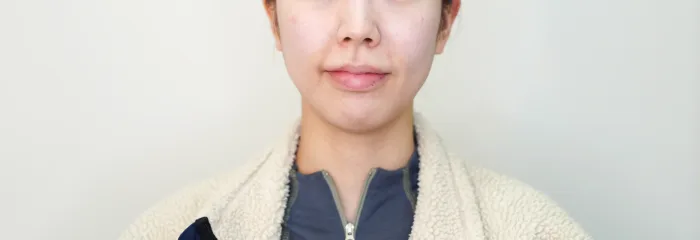 Before: 乔雅露 Volume