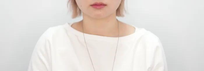 Before: 嘟嘟唇