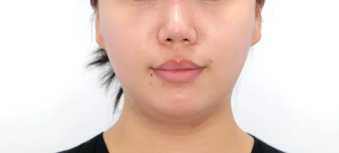 Before: 钛提升