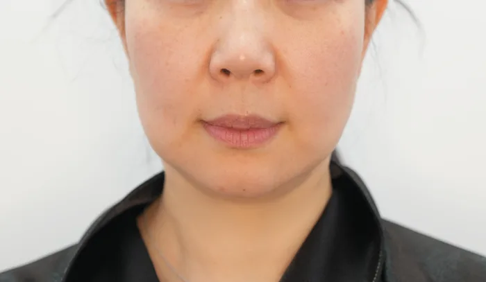 Before: 钛提升